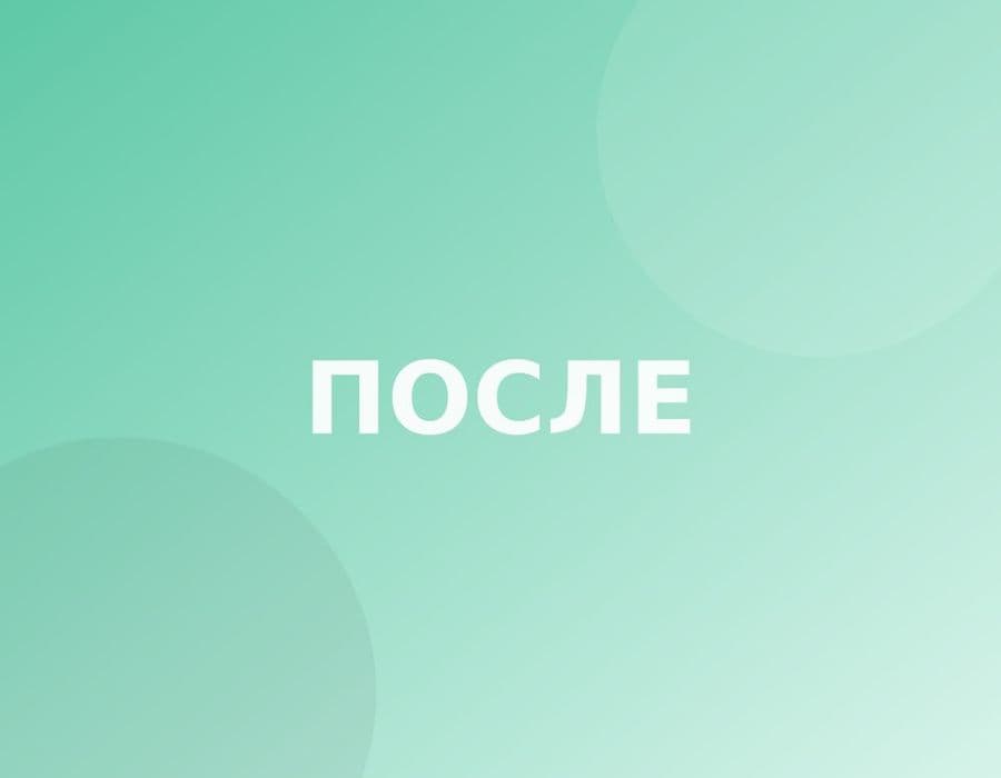 Работа «после»: Реставрация передних зубов